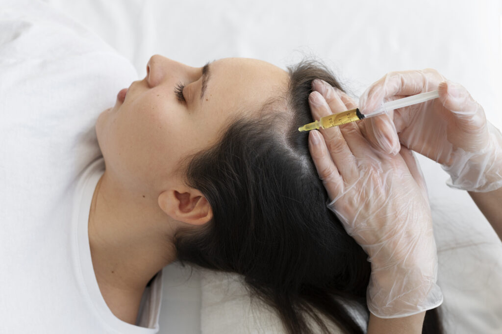 PRP Injections for Hair Loss