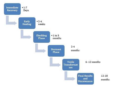 Hair Transplant Stages