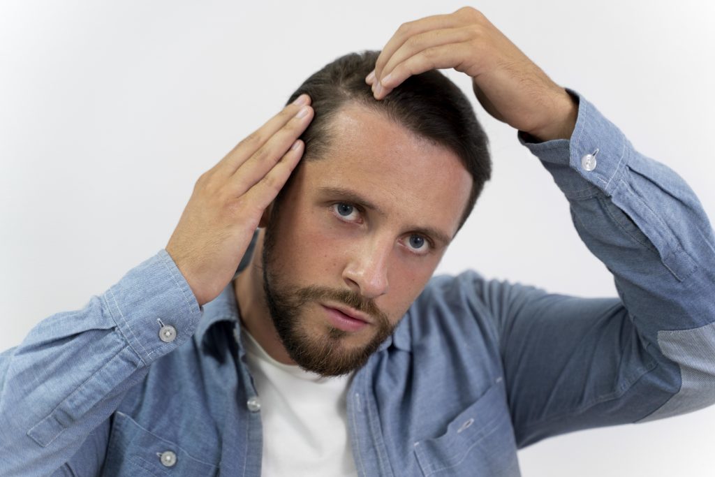 Androgenetic Alopecia